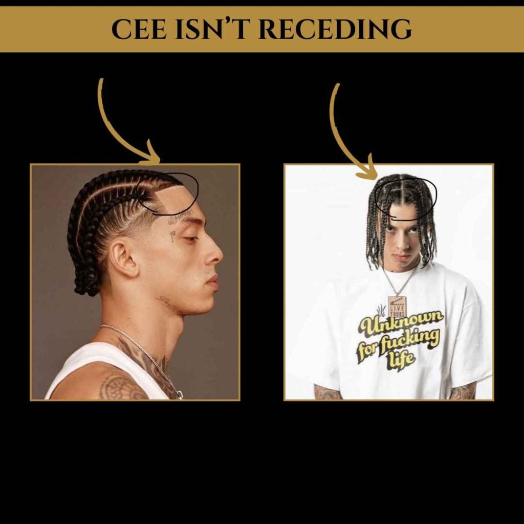 central-cee-hairline-braids Side profile and front-facing images of Central Cee showing his braids and natural hairline with text overlay “Cee Isn’t Receding."