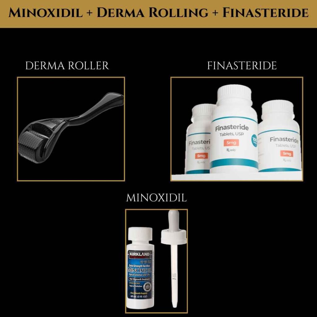 Minoxidil, Derma Rolling, and Finasteride Hair Loss Treatment Hair loss treatment kit with derma roller, finasteride bottles, and minoxidil dropper displayed on a black background with gold borders.