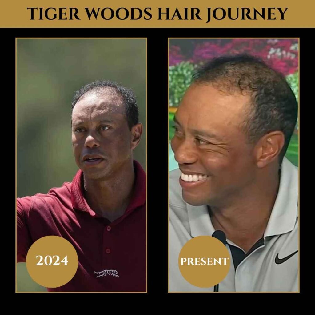 Tiger Woods Hair Journey Before and After Side-by-side comparison of Tiger Woods’ hair journey showing thinning hair in 2024 and improved appearance in the present.