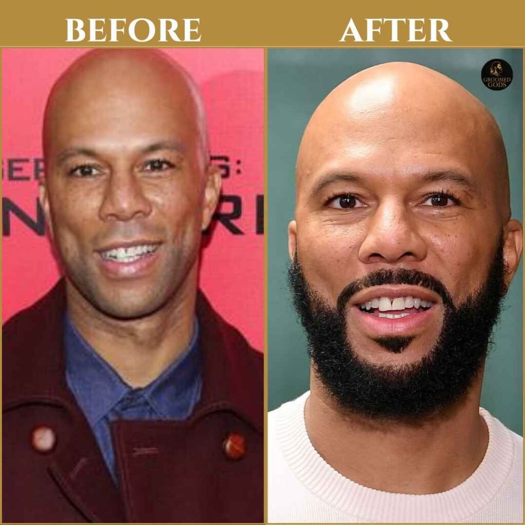 Common Beard Before and After – Black Men Beard Growth Example Before and after photo of rapper Common showing a transformation with a full beard vs clean-shaven look. Example of beard growth for Black men.